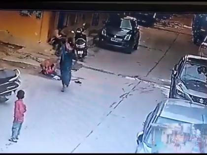 Hyderabad boy seriously injured in stray dog attack | Hyderabad boy seriously injured in stray dog attack