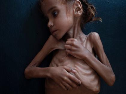 5 million Yemenis 'one step away from famine' in 2021, UN warns | 5 million Yemenis 'one step away from famine' in 2021, UN warns 5 million Yemenis 'one step away from famine' in 2021, UN warns | 5 million Yemenis 'one step away from famine' in 2021, UN warns