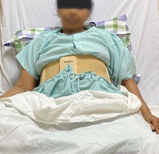 47-kg tumour removed from woman's abdomen | 47-kg tumour removed from woman's abdomen
