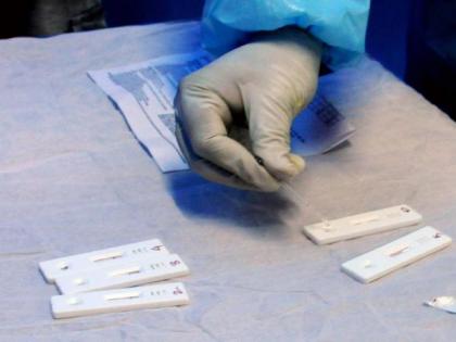 New single, rapid test can detect both HIV and TB | New single, rapid test can detect both HIV and TB New single, rapid test can detect both HIV and TB | New single, rapid test can detect both HIV and TB