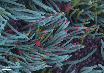 Co-infection with 'superbug' spikes Covid virus replication by 15-fold | Co-infection with 'superbug' spikes Covid virus replication by 15-fold Co-infection with 'superbug' spikes Covid virus replication by 15-fold | Co-infection with 'superbug' spikes Covid virus replication by 15-fold