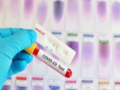 Home testing kits may give false negative reports even after having COVID symptoms: Expert | Home testing kits may give false negative reports even after having COVID symptoms: Expert