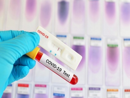 Over 13,000 coronavirus variants detected in Russia, says vaccine developer | Over 13,000 coronavirus variants detected in Russia, says vaccine developer