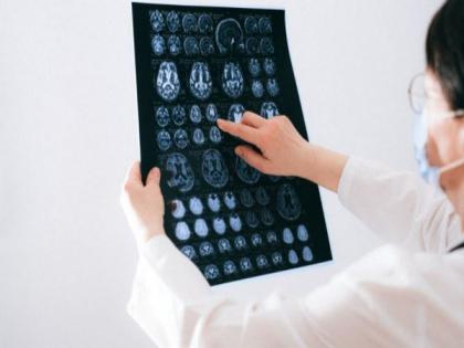 Predicting possible Alzheimer's with nearly 100 per cent accuracy: Study | Predicting possible Alzheimer's with nearly 100 per cent accuracy: Study