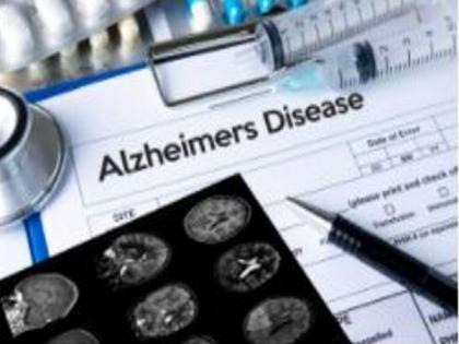 Study investigates role of gene associated with Alzheimer's disease in brain's immune cells | Study investigates role of gene associated with Alzheimer's disease in brain's immune cells
