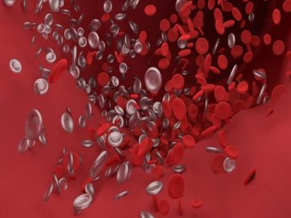 Using blood-clotting agent for bleeding stroke | Using blood-clotting agent for bleeding stroke Using blood-clotting agent for bleeding stroke | Using blood-clotting agent for bleeding stroke