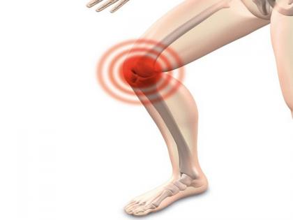 Study finds bone drug may be beneficial for knee osteoarthritis | Study finds bone drug may be beneficial for knee osteoarthritis Study finds bone drug may be beneficial for knee osteoarthritis | Study finds bone drug may be beneficial for knee osteoarthritis