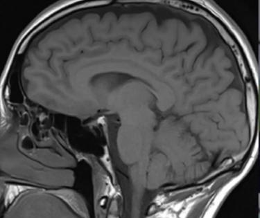 New drug-delivery system could treat brain disorders | New drug-delivery system could treat brain disorders New drug-delivery system could treat brain disorders | New drug-delivery system could treat brain disorders