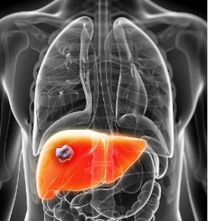 How a toxic liver can affect your health | How a toxic liver can affect your health