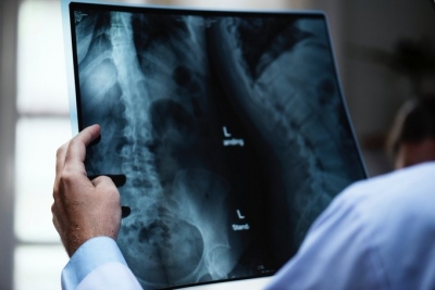 RSV can infect nerve cells, cause inflammation and damage: Study | RSV can infect nerve cells, cause inflammation and damage: Study RSV can infect nerve cells, cause inflammation and damage: Study | RSV can infect nerve cells, cause inflammation and damage: Study