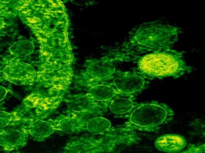 Researchers discover how bacteria adapt to new environment | Researchers discover how bacteria adapt to new environment