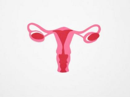 Study finds ovarian cancer therapy boosted by drug that slows disease's advance | Study finds ovarian cancer therapy boosted by drug that slows disease's advance Study finds ovarian cancer therapy boosted by drug that slows disease's advance | Study finds ovarian cancer therapy boosted by drug that slows disease's advance