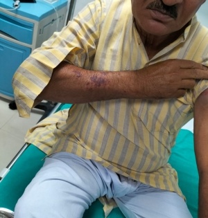 Elderly person beaten with iron rod in Greater Noida | Elderly person beaten with iron rod in Greater Noida