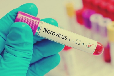 UK health authorities warn of potential second norovirus wave | UK health authorities warn of potential second norovirus wave UK health authorities warn of potential second norovirus wave | UK health authorities warn of potential second norovirus wave