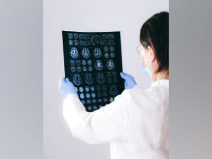 New super-resolution technique allows for more detailed brain imaging | New super-resolution technique allows for more detailed brain imaging