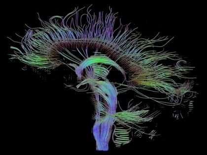 Transcral electrical stimulation can boost memory: Study | Transcral electrical stimulation can boost memory: Study