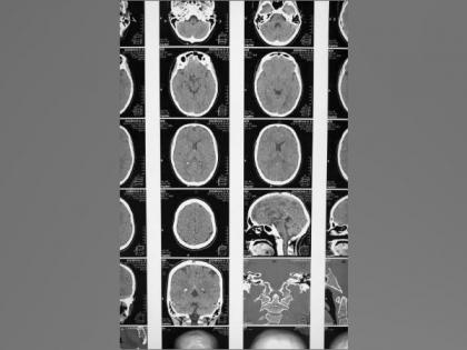 Researchers develop new drug-delivery system to treat brain disorders | Researchers develop new drug-delivery system to treat brain disorders Researchers develop new drug-delivery system to treat brain disorders | Researchers develop new drug-delivery system to treat brain disorders