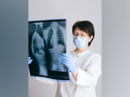 Study shares tips to protect lungs from damaged caused by TB | Study shares tips to protect lungs from damaged caused by TB Study shares tips to protect lungs from damaged caused by TB | Study shares tips to protect lungs from damaged caused by TB