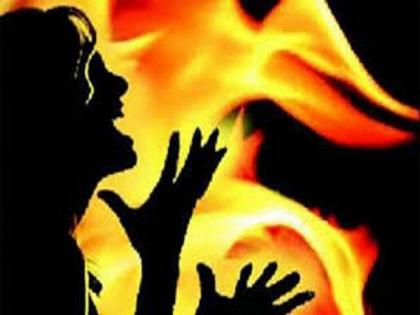 Parents set woman on fire over love affair in Andhra's Kadapa district | Parents set woman on fire over love affair in Andhra's Kadapa district Parents set woman on fire over love affair in Andhra's Kadapa district | Parents set woman on fire over love affair in Andhra's Kadapa district