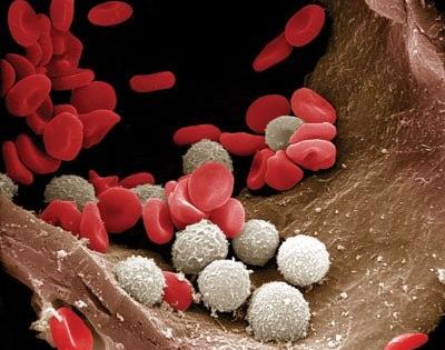 Covid-19 infection significantly changes our blood cells: Study | Covid-19 infection significantly changes our blood cells: Study