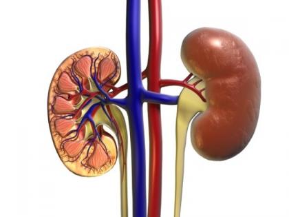 COVID-19 patients with end-stage renal disease 11 times more likely to be hospitalised than others: Study | COVID-19 patients with end-stage renal disease 11 times more likely to be hospitalised than others: Study COVID-19 patients with end-stage renal disease 11 times more likely to be hospitalised than others: Study | COVID-19 patients with end-stage renal disease 11 times more likely to be hospitalised than others: Study