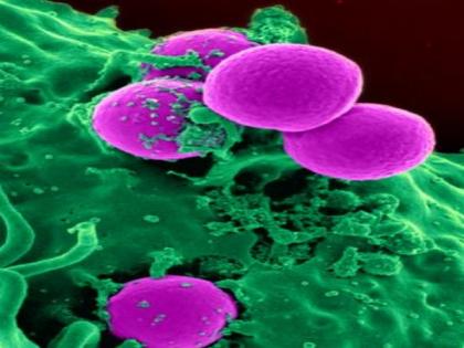 Study reveals how ecDNA forms, drives cancer drug resistance | Study reveals how ecDNA forms, drives cancer drug resistance Study reveals how ecDNA forms, drives cancer drug resistance | Study reveals how ecDNA forms, drives cancer drug resistance