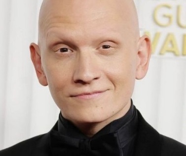 'Superman Legacy': Anthony Carrigan wanted to play Metamorpho before he even got the role | 'Superman Legacy': Anthony Carrigan wanted to play Metamorpho before he even got the role