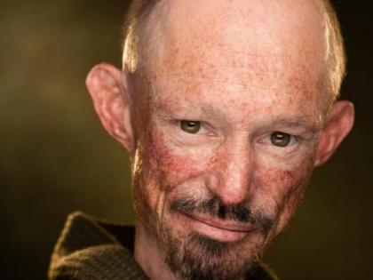 'GoT' actor Darren Kent dies at 39 after prolonged illness | 'GoT' actor Darren Kent dies at 39 after prolonged illness 'GoT' actor Darren Kent dies at 39 after prolonged illness | 'GoT' actor Darren Kent dies at 39 after prolonged illness