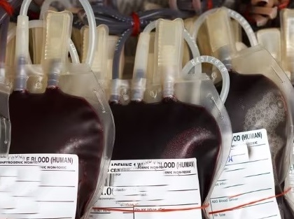 Donor cards can now be redeemed at all blood banks in UP | Donor cards can now be redeemed at all blood banks in UP