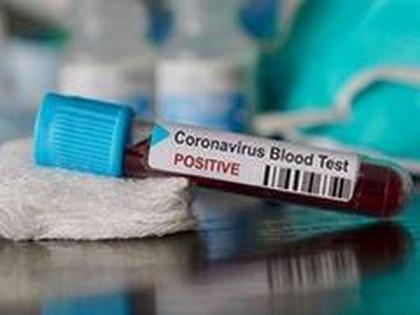 Woman inmate of Byculla prison tests positive for COVID-19 | Woman inmate of Byculla prison tests positive for COVID-19 Woman inmate of Byculla prison tests positive for COVID-19 | Woman inmate of Byculla prison tests positive for COVID-19