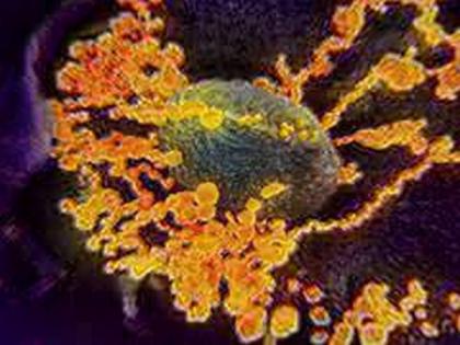 Coronavirus cases in Germany rise to 684 | Coronavirus cases in Germany rise to 684 Coronavirus cases in Germany rise to 684 | Coronavirus cases in Germany rise to 684