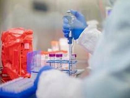 11 new cases of COVID-19 in Telangana, no deaths reported in last 24 hours | 11 new cases of COVID-19 in Telangana, no deaths reported in last 24 hours 11 new cases of COVID-19 in Telangana, no deaths reported in last 24 hours | 11 new cases of COVID-19 in Telangana, no deaths reported in last 24 hours