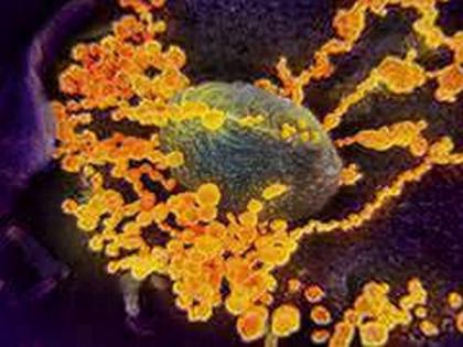 Coronavirus : 459 passengers of luxury cruise ship screened in Kochi | Coronavirus : 459 passengers of luxury cruise ship screened in Kochi Coronavirus : 459 passengers of luxury cruise ship screened in Kochi | Coronavirus : 459 passengers of luxury cruise ship screened in Kochi