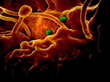 Three patients with suspected coronavirus tested negative at RML hospital in Delhi | Three patients with suspected coronavirus tested negative at RML hospital in Delhi Three patients with suspected coronavirus tested negative at RML hospital in Delhi | Three patients with suspected coronavirus tested negative at RML hospital in Delhi