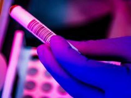 Telangana reports 206 new cases of COVID-19 | Telangana reports 206 new cases of COVID-19 Telangana reports 206 new cases of COVID-19 | Telangana reports 206 new cases of COVID-19