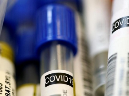 Airline passenger tests COVID-19 positive in Coimbatore | Airline passenger tests COVID-19 positive in Coimbatore