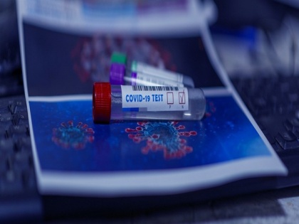 Study reveals blood tests can offer early indicator of severe COVID-19 | Study reveals blood tests can offer early indicator of severe COVID-19