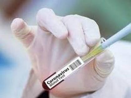 Indonesia's coronavirus tally passes 33,000 after record daily increase | Indonesia's coronavirus tally passes 33,000 after record daily increase