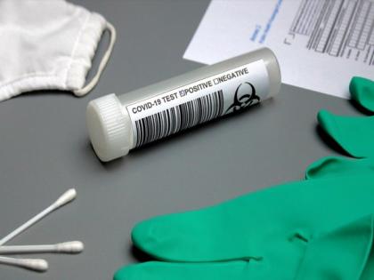 Researchers create new test to quickly identify COVID-19 infection and severity | Researchers create new test to quickly identify COVID-19 infection and severity