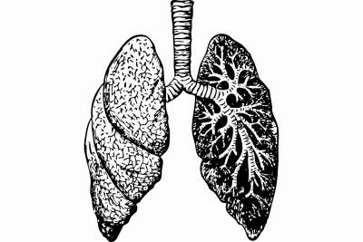 This compound may help avert lung destruction in Covid patients | This compound may help avert lung destruction in Covid patients