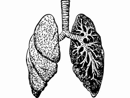 Covid patients continue to suffer from lung complications | Covid patients continue to suffer from lung complications