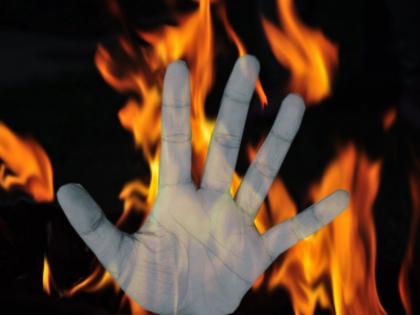 UP: Restaurant owner sets youth on fire over theft suspicion | UP: Restaurant owner sets youth on fire over theft suspicion