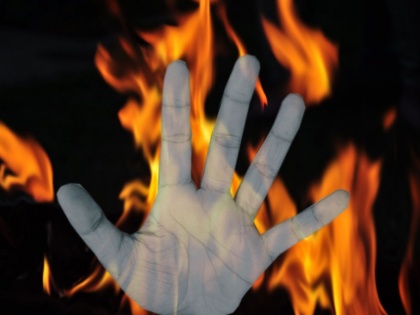 UP rape survivor sets herself on fire | UP rape survivor sets herself on fire