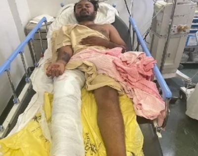K'taka acid attacker injured in police shootout | K'taka acid attacker injured in police shootout