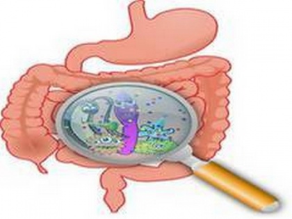 'Good' bacteria show promise for clinical treatment of Crohn's disease, ulcerative colitis | 'Good' bacteria show promise for clinical treatment of Crohn's disease, ulcerative colitis