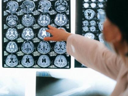 Single MRI scan can classify brain tumours using deep learning model | Single MRI scan can classify brain tumours using deep learning model