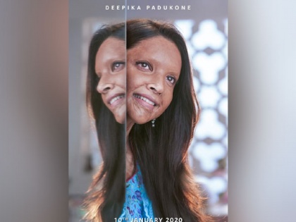 Deepika Padukone drops trailer of 'Chhapaak' | Deepika Padukone drops trailer of 'Chhapaak'