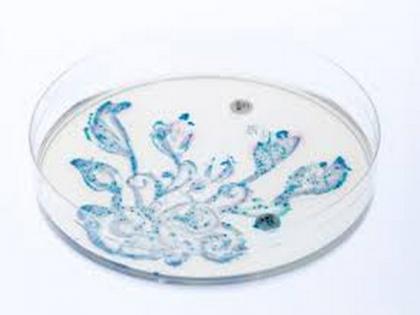 Gut bacteria may be linked with Pulmonary Arterial Hypertension | Gut bacteria may be linked with Pulmonary Arterial Hypertension Gut bacteria may be linked with Pulmonary Arterial Hypertension | Gut bacteria may be linked with Pulmonary Arterial Hypertension