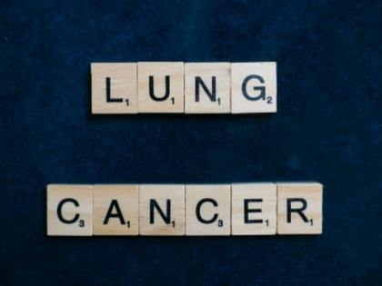 Scientists develop model to predict patients with poor lung cancer outcomes | Scientists develop model to predict patients with poor lung cancer outcomes