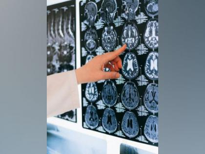 Redundant modular network supports proper brain communication: Study | Redundant modular network supports proper brain communication: Study Redundant modular network supports proper brain communication: Study | Redundant modular network supports proper brain communication: Study